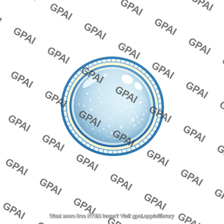 Extracellular vesicle