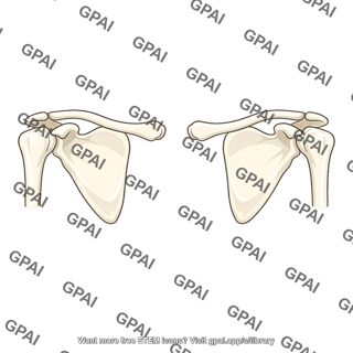 Shoulder girdle