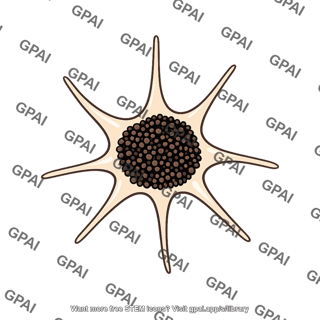 Melanocyte pigment aggregated