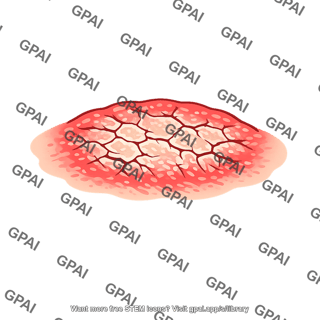 Skin lesion