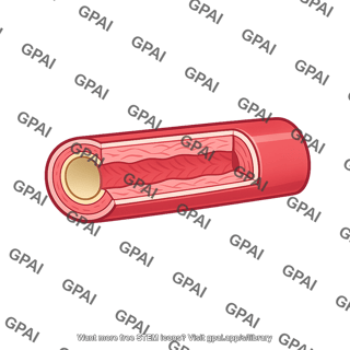 Coronary artery cutaway