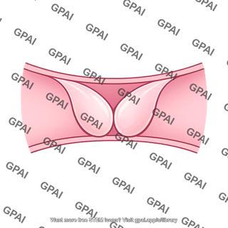 Strapless bra