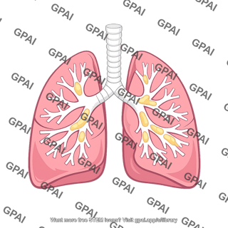 Cystic fibrosis