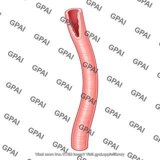 Esophagus