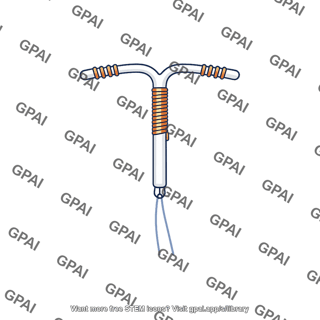 Intrauterine device