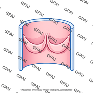 Venous valve