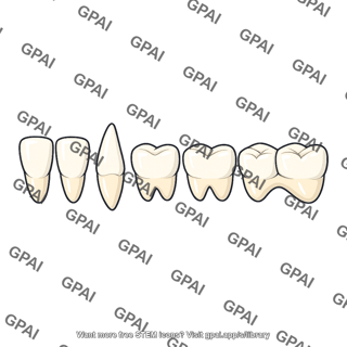 Tooth differentiated