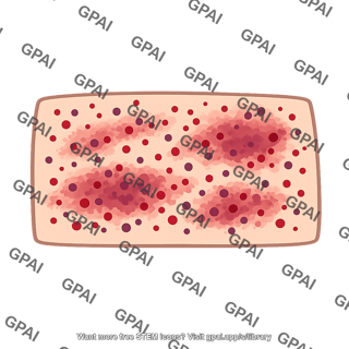 Skin bleeding