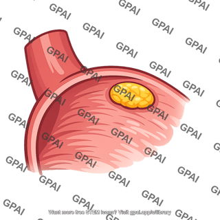 Sinoatrial node