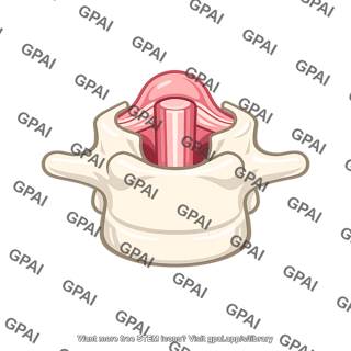 Spina bifida