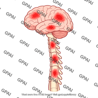 Encephalomyelitis
