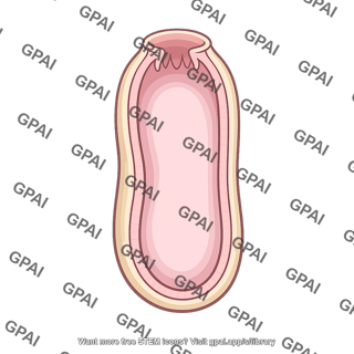 Gastrovascular cavity