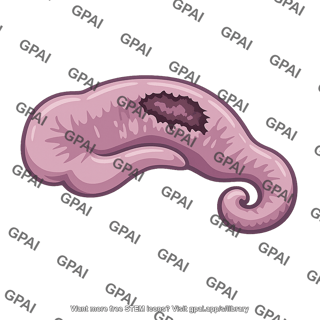 Hippocampus damaged