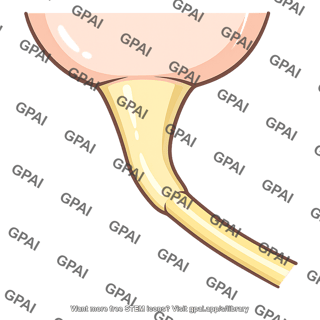 Axon hillock