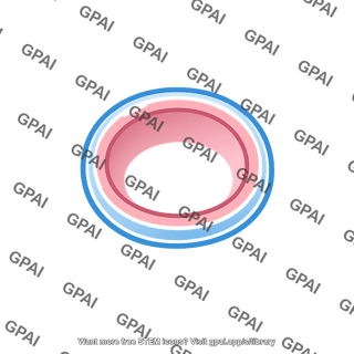 Concentric ovals