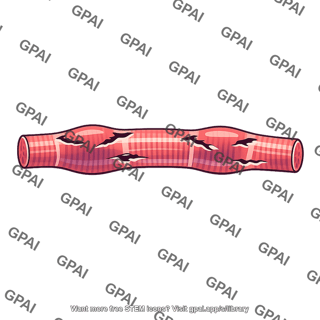 Small muscle fiber damaged