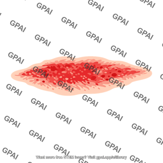 Scrape