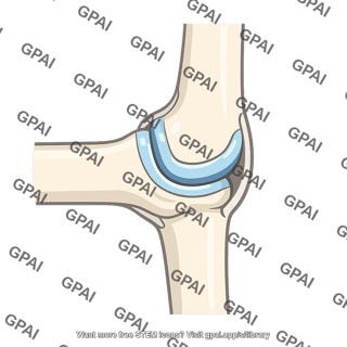 Hinge joint