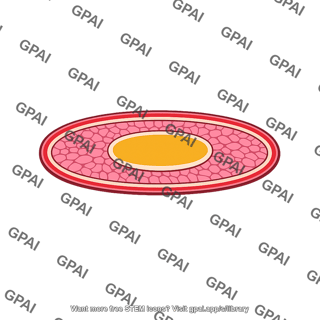 Acoelomate body