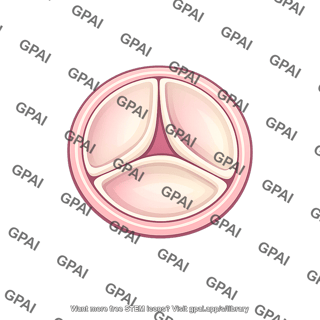 Arterial valve