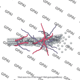 Microtubule disintegrating with tau protein tangle
