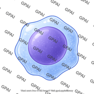 Lymphocyte neoplastic