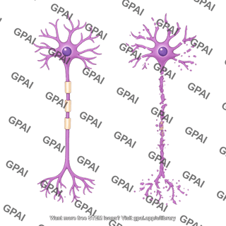 Multipolar neuron motor axon degeneration