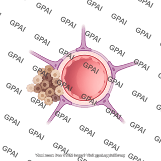 Blood brain barrier cross section with metastasizing tumor