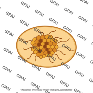 Etioplast