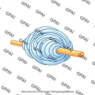 Schwann cell onion bulb abnormal