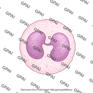 Neutrophil pelger huet anomaly