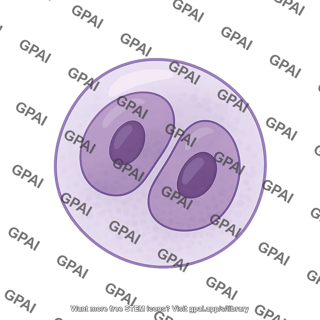 Reed sternberg cells