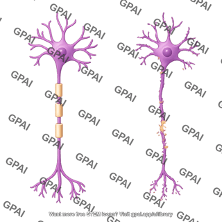 Multipolar neuron motor axon dendrite degeneration