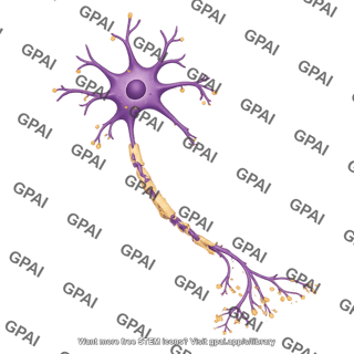 Multipolar neuron motor myelinated degenerating