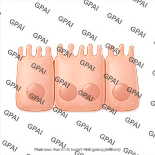 Enterocyte flattened 4