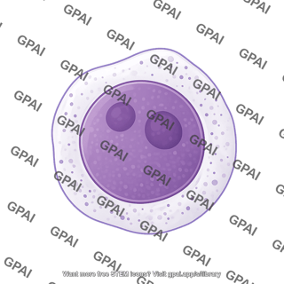 Myeloblast acute myeloid leukemia