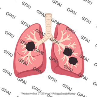Lung cancer