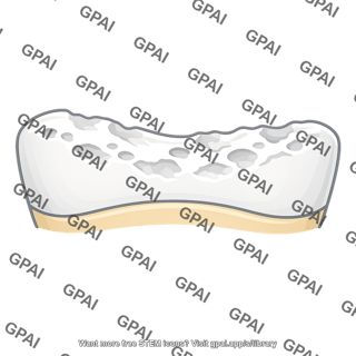Tooth enamel dissolving