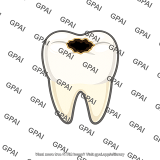 Tooth cavity
