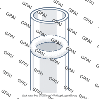 White ring ammonium chloride