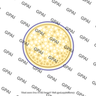Cyst