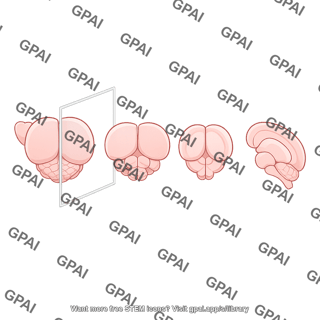 Mouse brain dorsal view caudal rostral turn coronal cut