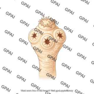 Taenia solium scolex