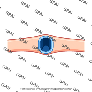 Membrane pore