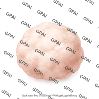 Mouse tumor 1