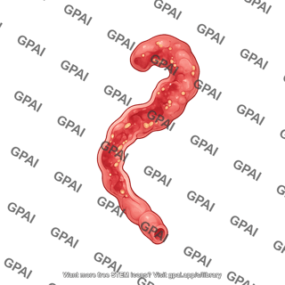 Mouse colon colitis