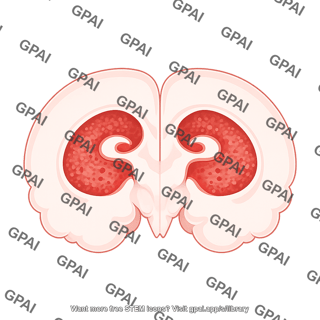 Mouse brain coronal lateral ventricle huntington s disease