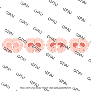 Mouse brain coronal lateral ventricles atrophy