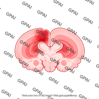 Mouse brain coronal tbi