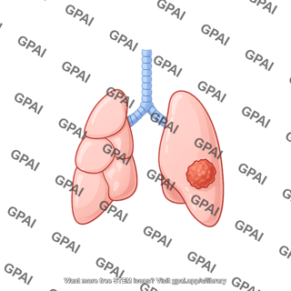 Mouse lung with tumor